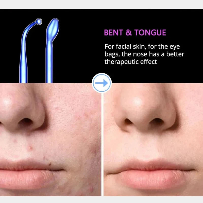 High Frequency Facial Wand | 6-Electrode Acne & Skin Care Kit